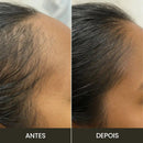 Escova de Terapia Capilar 4 em 1: LumiScalp