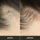 Escova de Terapia Capilar 4 em 1: LumiScalp