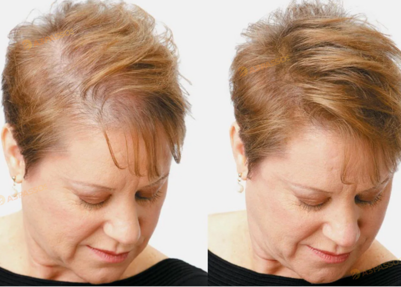 Toppik Hair | Fibra Capilar para Cobertura Instantânea