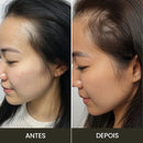 Escova de Terapia Capilar 4 em 1: LumiScalp